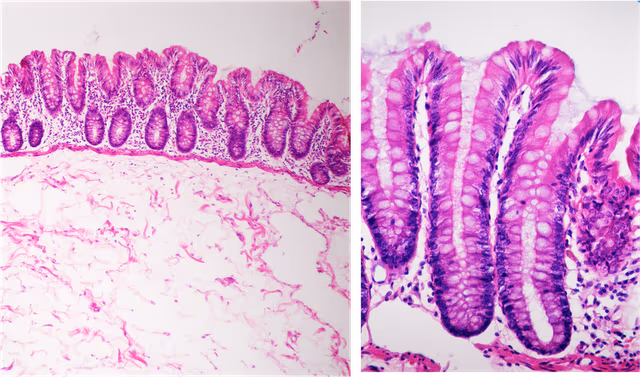 Vellosidades intestinales para la absorción